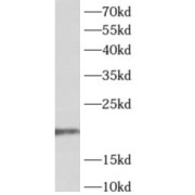 WB analysis of A431 cell lysate, using tRNA-Specific Adenosine Deaminase 2 (ADAT2) antibody (1/400 dilution).