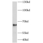 WB analysis of mouse brain tissue, using ADCK5 antibody (1/800 dilution).