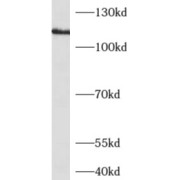 abx230155
