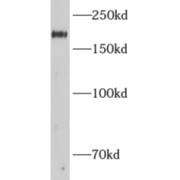 abx230156