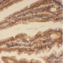 Alcohol Dehydrogenase 8 (ADHFE1) Antibody