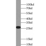 WB analysis of human adipose tissue, using ADIPOQ antibody (1/1000 dilution).