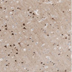 2-Aminoethanethiol Dioxygenase (ADO) Antibody