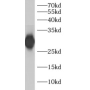 WB analysis of human brain tissue, using ADO antibody (1/300 dilution).