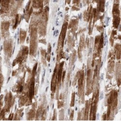 Beta-2 Adrenergic Receptor (ADRB2) Antibody