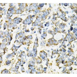 Adenylosuccinate Synthetase Isozyme 2 (ADSS) Antibody