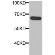 WB analysis of MCF7 cells, using AEG-1 antibody (1/1000 dilution).