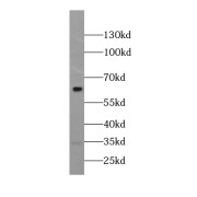 WB analysis of Jurkat cells, using MLLT3 antibody (1/600 dilution).