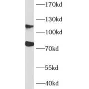 WB analysis of rat brain tissue, using AFAP1 antibody (1/1000 dilution).
