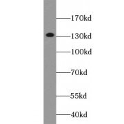 WB analysis of K-562 cells, using AFF1-Specific antibody (1/1000 dilution).