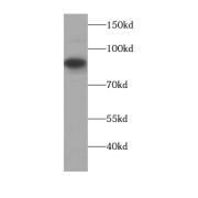 WB analysis of human blood tissue, using AFM antibody (1/1000 dilution).