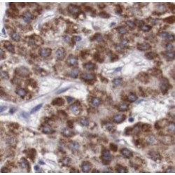Alpha-Fetoprotein (AFP) Antibody