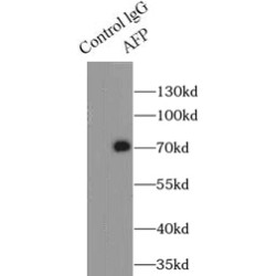Alpha-Fetoprotein (AFP) Antibody