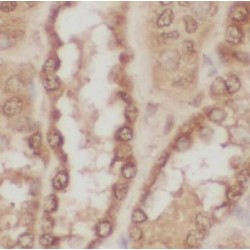 Anti-Glycolipid Antibody (AGA) Antibody