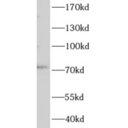 WB analysis of mouse liver tissue, using AGBL3 antibody (1/300 dilution).