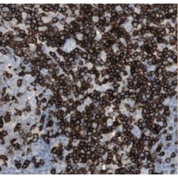 ArfGAP With FG Repeats 2 (AGFG2) Antibody