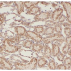 Glycerol-3-Phosphate Acyltransferase 3 (GPAT3) Antibody