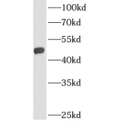 WB analysis of rat kidney tissue, using GPAT3 antibody (1/1500 dilution).