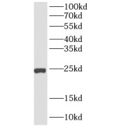WB analysis of SKOV-3 cells, using AGR3 antibody (1/600 dilution).