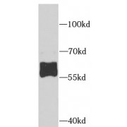 WB analysis of Jurkat cells, using AHCYL1 antibody (1/1000 dilution).