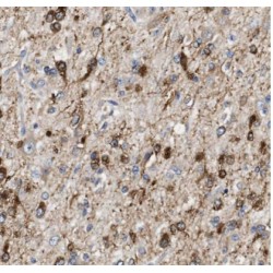Activator of 90 kDa Heat Shock Protein ATPase Homolog 1 (AHSA1) Antibody