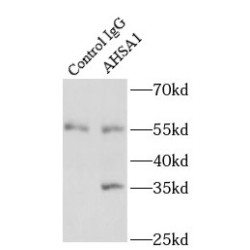 Activator of 90 kDa Heat Shock Protein ATPase Homolog 1 (AHSA1) Antibody