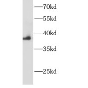 WB analysis of A549 cells, using AHSA1 antibody (1/600 dilution).