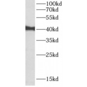 WB analysis of K-562 cells, using AIM2 antibody (1/1000 dilution).