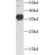 WB analysis of HepG2 cells, using AIP antibody (1/300 dilution).