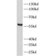WB analysis of HeLa cells, using Ajuba antibody (1/1000 dilution).