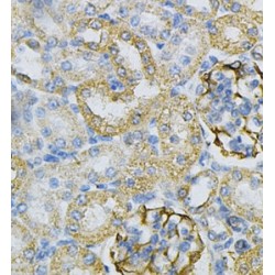 Adenylate Kinase 1 (AK1) Antibody