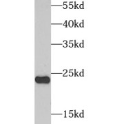 WB analysis of human heart tissue, using AK1 antibody (1/1000 dilution).