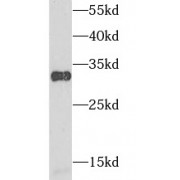 WB analysis of HeLa cells, using AK2 antibody (1/1000 dilution).