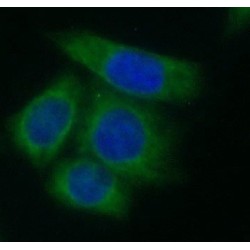Adenylate Kinase 2 (AK2) Antibody