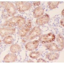 A-Kinase Anchor Protein 14 (AKAP14) Antibody