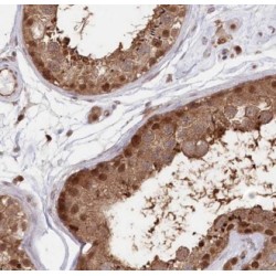 A-Kinase Anchor Protein 3 (AKAP3) Antibody