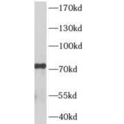 WB analysis of PC-3 cells, using AKAP8L antibody (1/300 dilution).