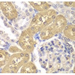 Aldo-Keto Reductase Family 1 Member A1 (AKR1A1) Antibody