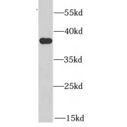 WB analysis of HeLa cells, using AKR1A1 antibody (1/1000 dilution).
