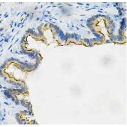 Aldose Reductase (AKR1B1) Antibody
