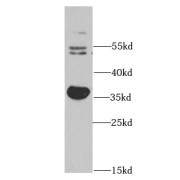 WB analysis of HepG2 cells, using AKR1C3 antibody (1/1000 dilution).