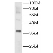 WB analysis of mouse testis tissue, using AKR1CL2 antibody (1/500 dilution).