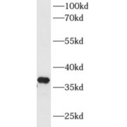 WB analysis of mouse liver tissue, using AKR1D1 antibody (1/600 dilution).