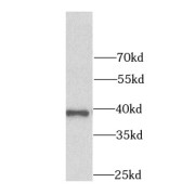 WB analysis of HepG2 cells, using AKR7A2 antibody (1/1000 dilution).