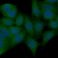 RAC-Alpha Serine/threonine-Protein Kinase (AKT1) Antibody