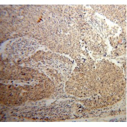 RAC-Alpha Serine/threonine-Protein Kinase (AKT1) Antibody