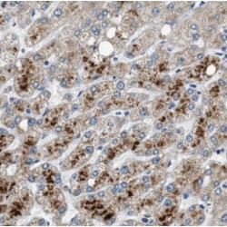 RAC-Beta Serine/threonine-Protein Kinase (AKT2) Antibody