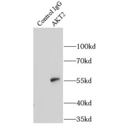 RAC-Beta Serine/threonine-Protein Kinase (AKT2) Antibody