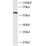 WB analysis of MCF7 cells, using AKT3 antibody (1/500 dilution).