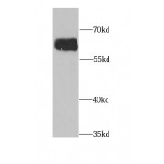 WB analysis of SH-SY5Y cells, using AAAS antibody (1/600 dilution).